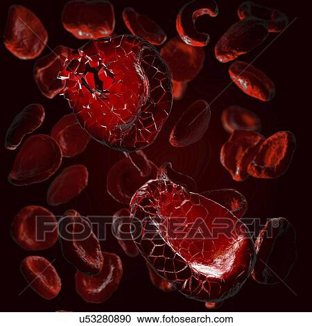 Disintegrating red blood cells, illustration View Large Photo Image Stock Image - Disintegrating red blood cells, illustration. Fotosearch