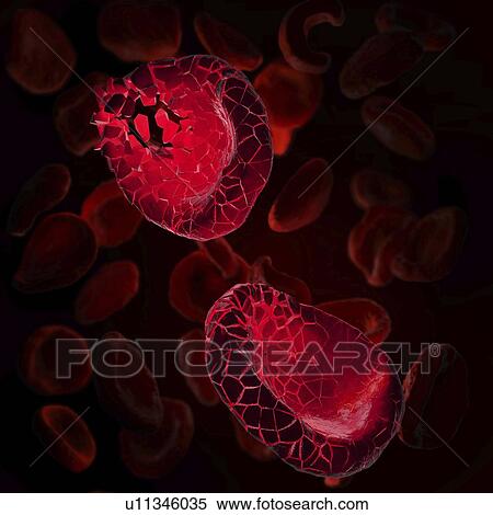 Stock Photography - Disintegrating red blood cells, illustration. Fotosearch