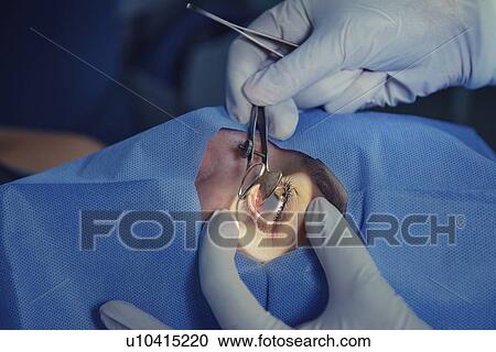 Stock Image - Eye surgery. Fotosearch