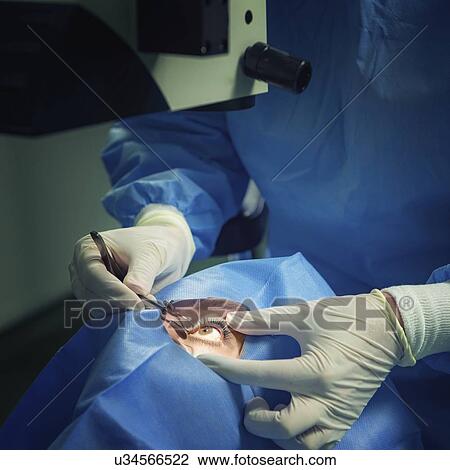 Stock Image - Eye surgery. Fotosearch