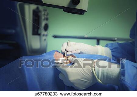 Stock Image - Eye surgery. Fotosearch