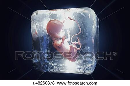 Stock Photo - Frozen foetus, conceptual illustration. Fotosearch