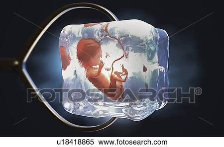 Frozen foetus, conceptual illustration View Large Photo Image Stock Photography - Frozen foetus, conceptual illustration. Fotosearch
