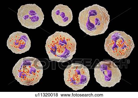 Stock Photo - Gonorrhoeae bacteria inside neutrophils, illustration. Fotosearch