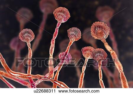 Stock Image - Green mould conidiophores, illustration. Fotosearch