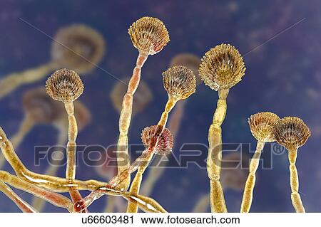 Stock Image - Green mould conidiophores, illustration. Fotosearch