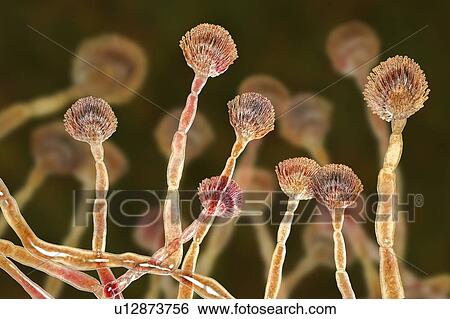 Stock Photograph - Green mould conidiophores, illustration. Fotosearch