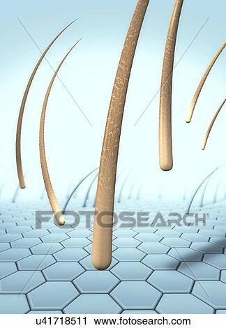 Hair loss, conceptual illustration View Large Photo Image Stock Image - Hair loss, conceptual illustration. Fotosearch