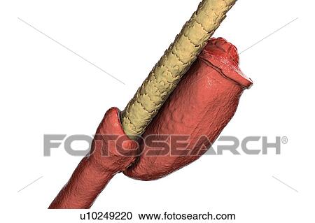 Head louse nits, illustration View Large Photo Image Stock Image - Head louse nits, illustration. Fotosearch