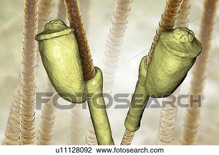 Stock Image - Head louse nits, illustration. Fotosearch