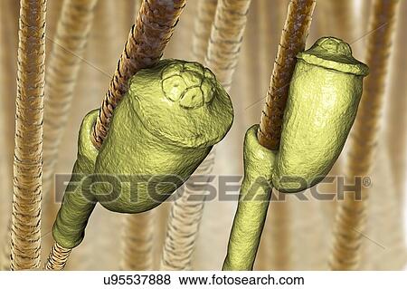 Stock Photo - Head louse nits, illustration. Fotosearch