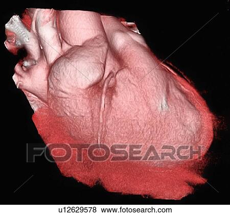 Stock Photo - Healthy heart, 3D computed tomography (CT) scan.. Fotosearch