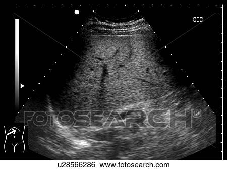Stock Photograph - Healthy liver, ultrasound scan.. Fotosearch