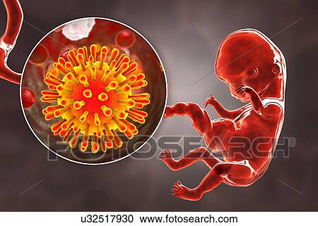 HIV infecting human embryo, illustration View Large Photo Image Stock Image - HIV infecting human embryo, illustration. Fotosearch
