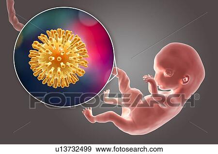 HIV infecting human embryo, illustration View Large Photo Image Stock Photo - HIV infecting human embryo, illustration. Fotosearch