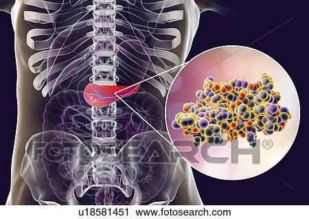 Human pancreas and insulin molecule, illustration View Large Photo Image Stock Image - Human pancreas and insulin molecule, illustration. Fotosearch