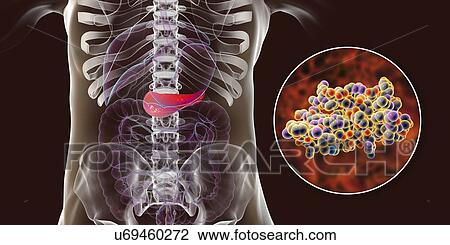 Stock Image - Human pancreas and insulin molecule, illustration. Fotosearch
