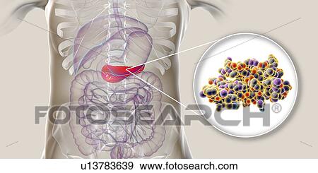 Stock Photo - Human pancreas and insulin molecule, illustration. Fotosearch