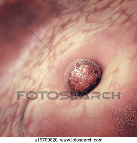 Stock Photo - Implantation of embryo, illustration. Fotosearch