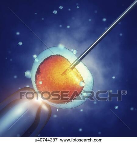In vitro fertilisation, illustration View Large Photo Image Stock Photo - In vitro fertilisation, illustration. Fotosearch