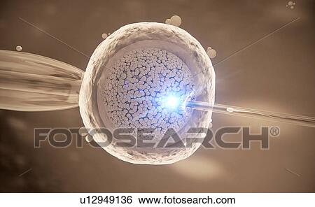 Stock Photograph - In vitro fertilization, illustration. Fotosearch