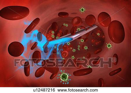 Injection into the bloodstream, illustration View Large Photo Image Stock Photograph - Injection into the bloodstream, illustration. Fotosearch