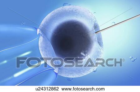 IVF, illustration View Large Photo Image Stock Image - IVF, illustration. Fotosearch