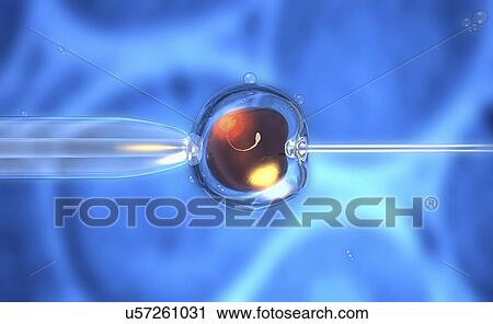 IVF, illustration View Large Photo Image Stock Image - IVF, illustration. Fotosearch