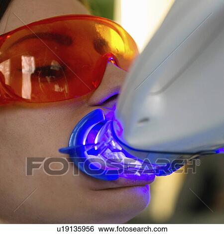 Stock Photograph - Laser teeth whitening. Fotosearch