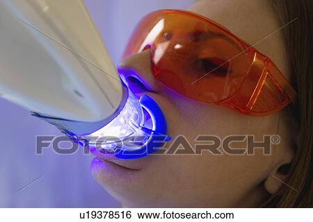 Laser teeth whitening View Large Photo Image Stock Photograph - Laser teeth whitening. Fotosearch