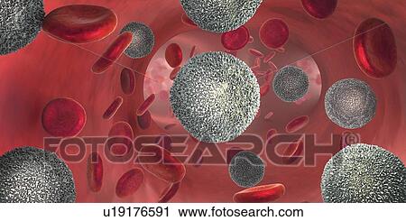 Leukaemia, illustration View Large Photo Image Stock Image - Leukaemia, illustration. Fotosearch