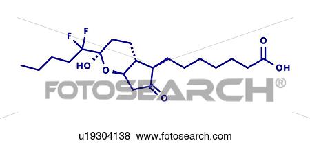 Stock Photo - Lubiprostone chronic constipation drug, molecular model. Fotosearch