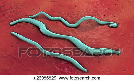 Lyme disease bacteria, illustration View Large Photo Image Stock Photo - Lyme disease bacteria, illustration. Fotosearch