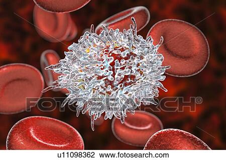 Stock Image - Lymphocyte in hairy cell leukaemia, illustration. Fotosearch