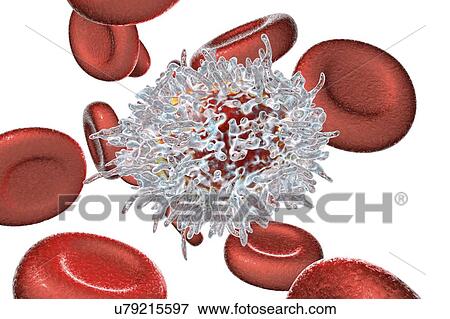 Stock Photo - Lymphocyte in hairy cell leukaemia, illustration. Fotosearch