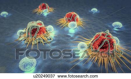 Stock Photo - Lymphocytes attacking cancer cells, illustration. Fotosearch