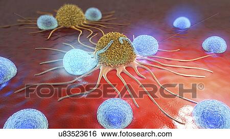 Lymphocytes attacking cancer cells, illustration View Large Photo Image Stock Photograph - Lymphocytes attacking cancer cells, illustration. Fotosearch