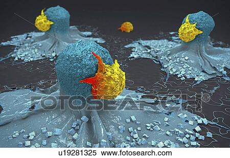Stock Photography - Lymphocytes attacking cancer cells, illustration. Fotosearch