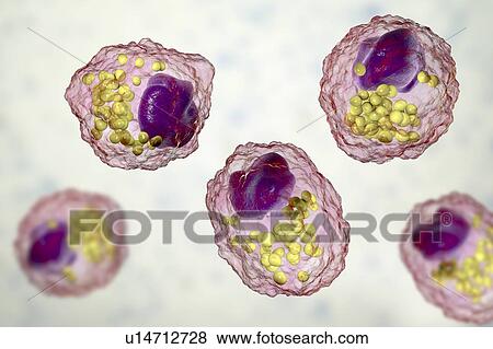 Stock Photo - Macrophage foam cell, illustration. Fotosearch