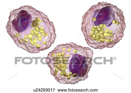 Macrophage foam cell, illustration View Large Photo Image Stock Photo - Macrophage foam cell, illustration. Fotosearch