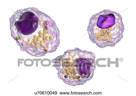 Stock Photo - Macrophage foam cell, illustration. Fotosearch