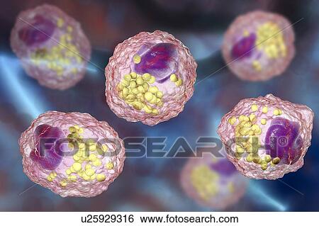 Stock Photograph - Macrophage foam cell, illustration. Fotosearch