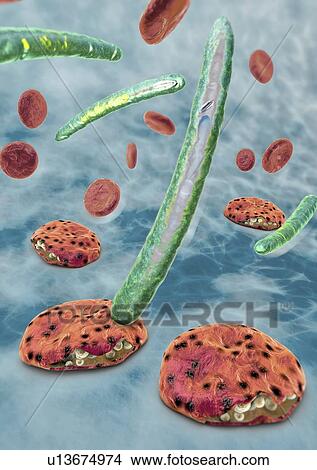 Picture - Malaria, illustration. Fotosearch