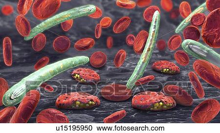 Malaria, illustration View Large Photo Image Stock Image - Malaria, illustration. Fotosearch