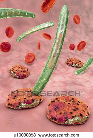 Stock Photo - Malaria, illustration. Fotosearch