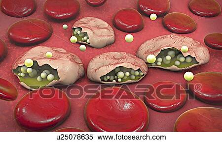 Stock Photography - Malaria, illustration. Fotosearch