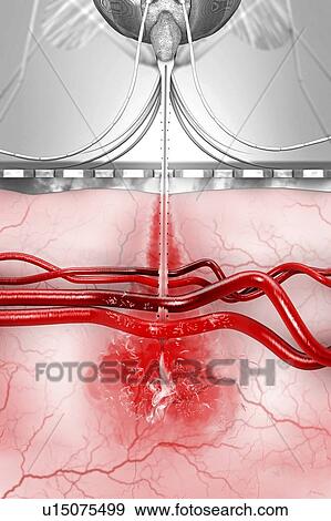 Stock Photo - Malaria transmission, illustration. Fotosearch