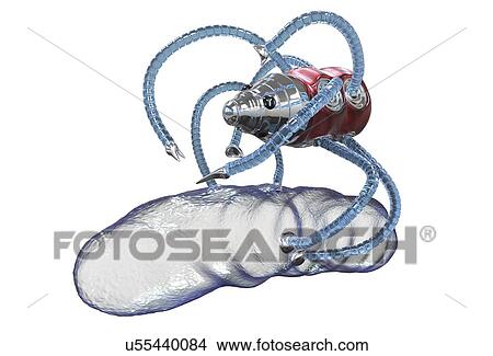 Medical nanorobot fighting with bacterium, illustration View Large Photo Image Picture - Medical nanorobot fighting with bacterium, illustration. Fotosearch