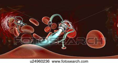 Stock Photograph - Medical nanorobot, illustration. Fotosearch