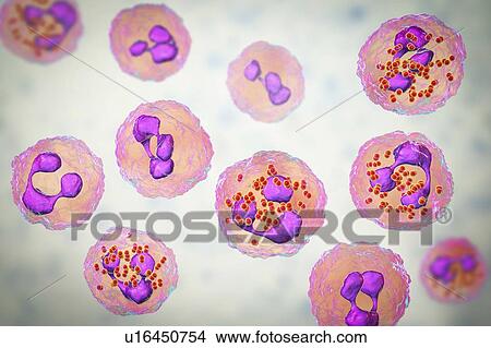 Meningococcal meningitis, illustration View Large Photo Image Picture - Meningococcal meningitis, illustration. Fotosearch